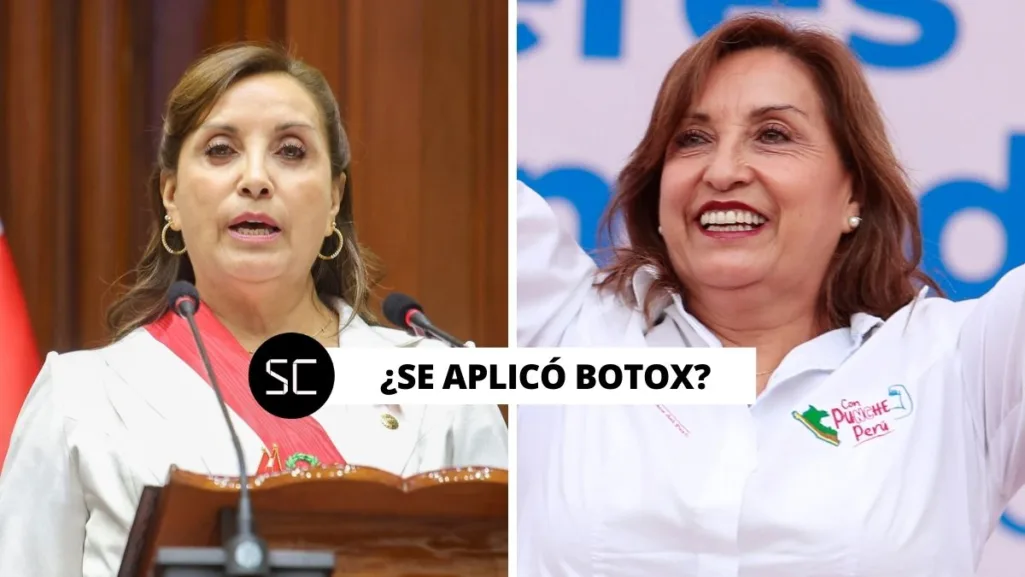 ¿Dina Boluarte se operó la nariz y se aplicó botox para eliminar las arrugas?